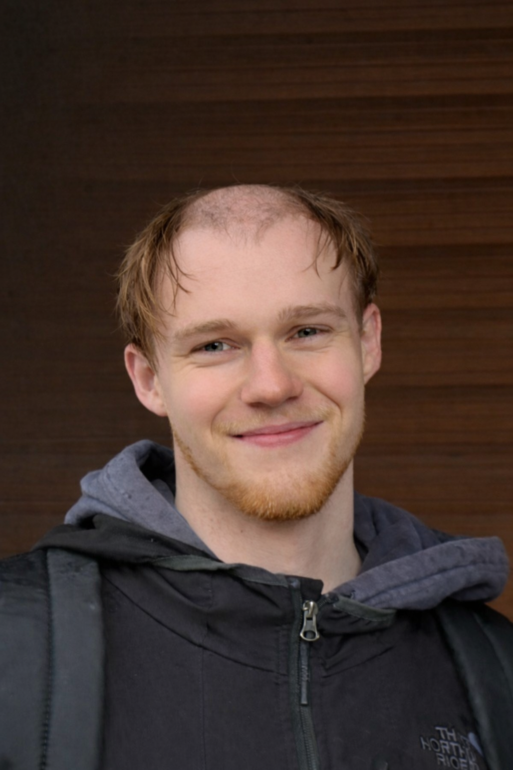 Telmö beginning to lose his hair
